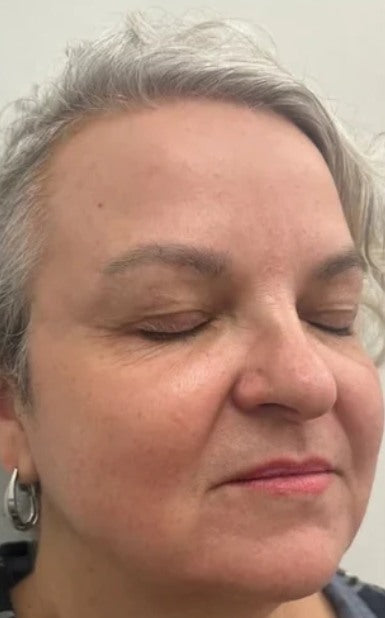 Después: piel del rostro tras el uso de la crema